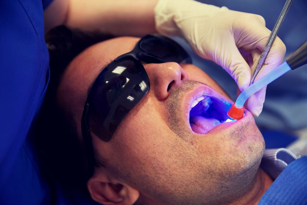 laser vs normal dental fillings: pain, benefits & effect on gums